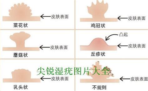 陰毛好癢|陰毛瘙癢及皮膚變化原因解析